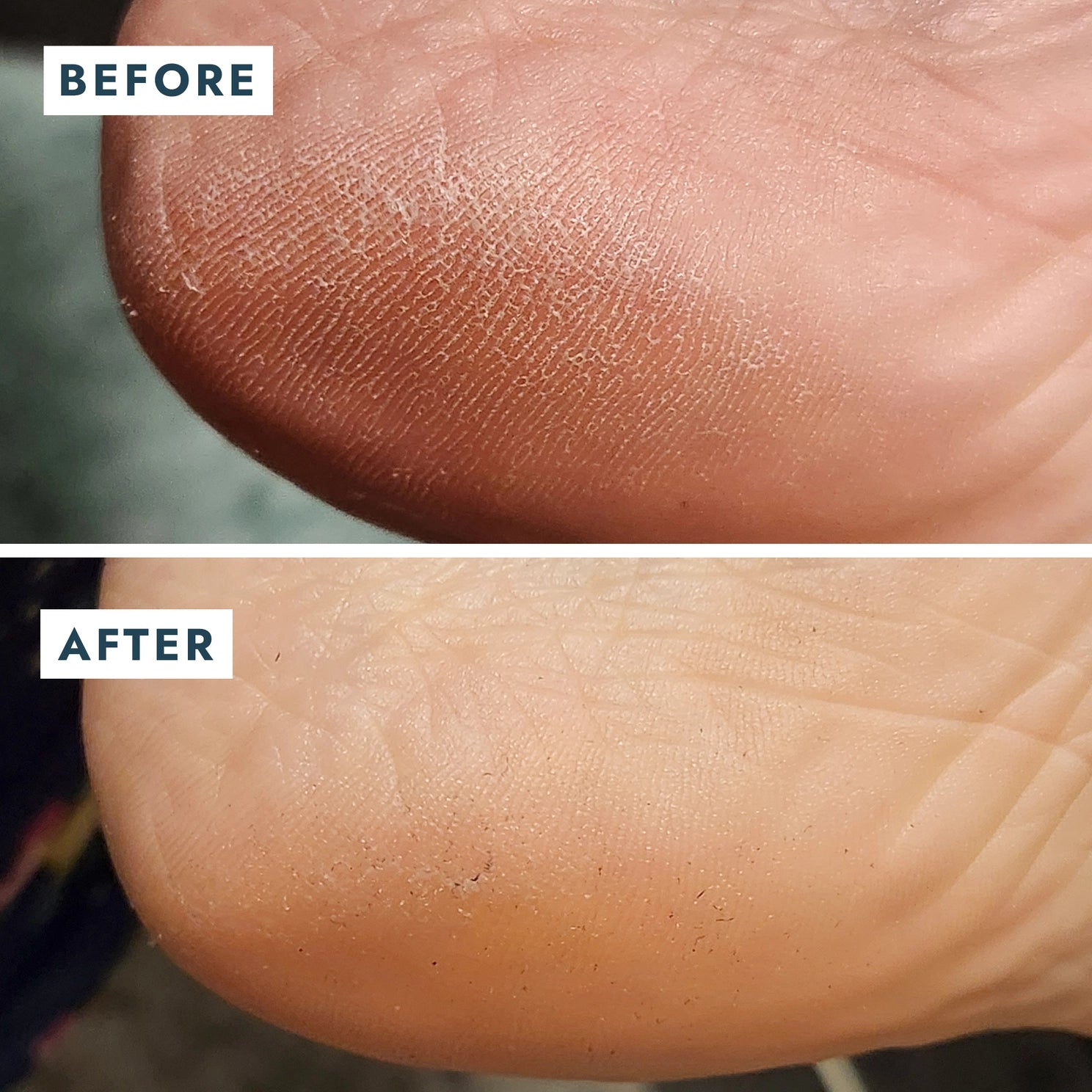VOESH New York Solemate Heel Repair Balm Retail - Mint